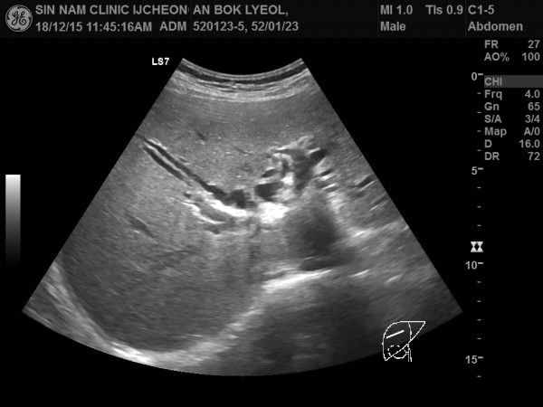 df11cede29e8e7ff81e69710e8313865_1756275