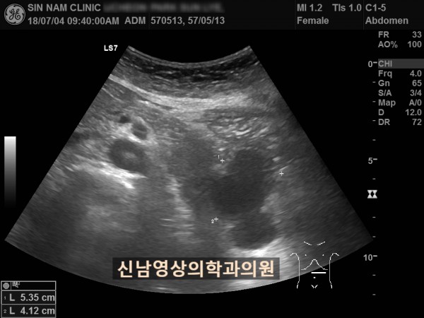 2ad35bb8fdde78a88fb8c45a7739a700_1757042