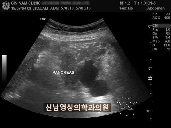 2ad35bb8fdde78a88fb8c45a7739a700_1757042