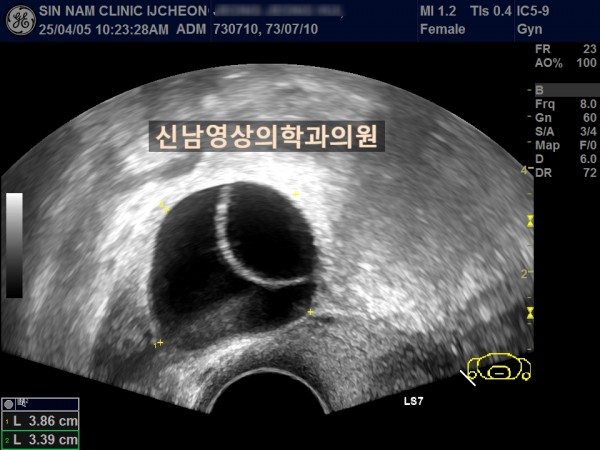 2ad35bb8fdde78a88fb8c45a7739a700_1757044